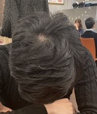 23歳男です 最近周囲から 髪のボリューム減ったね 前より Yahoo 知恵袋