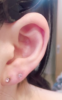 ピアス軟膏って良いんですか 良くないって聞いたけど Yahoo 知恵袋