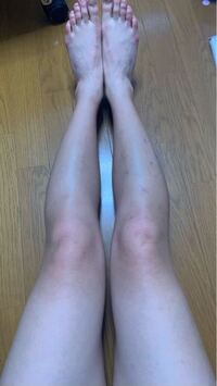 ふくらはぎが36cmあります 現在17歳です 脚痩したいと思うのですが Yahoo 知恵袋