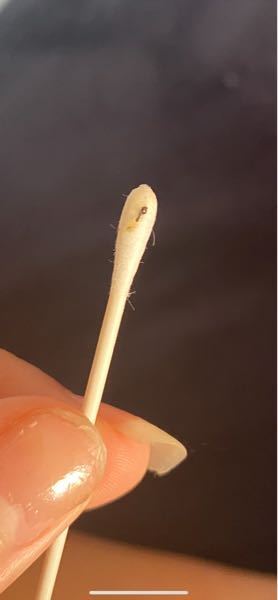 目頭から黒いものが出てきます 夏から目やにがすごく出てくるので1時 Yahoo 知恵袋