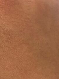 美白になりたい 中学生です 肌は黒くなく白くなくって感 Yahoo 知恵袋