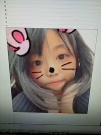 こどものふっくらした頬はかわいいですか W Yahoo 知恵袋