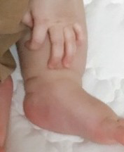 赤ちゃんの足首の 太さはみんな同じですか また 赤ちゃんの体型や他の所の Yahoo 知恵袋