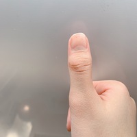 この指ってマムシ指ですか 今日友達にマムシ指だとからかわれました 前々か Yahoo 知恵袋