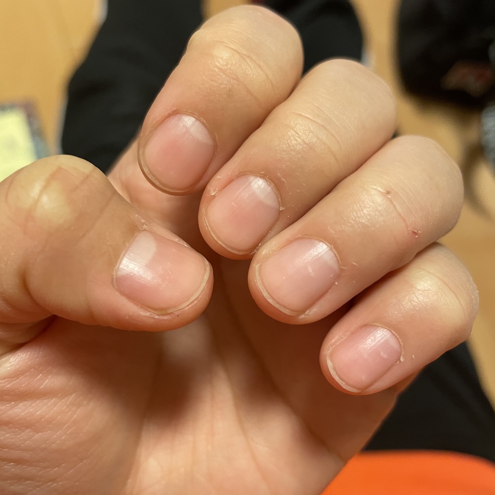 ネイルケア すべての質問 Yahoo 知恵袋