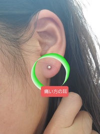 最速 貼るコンシーラー ピアス