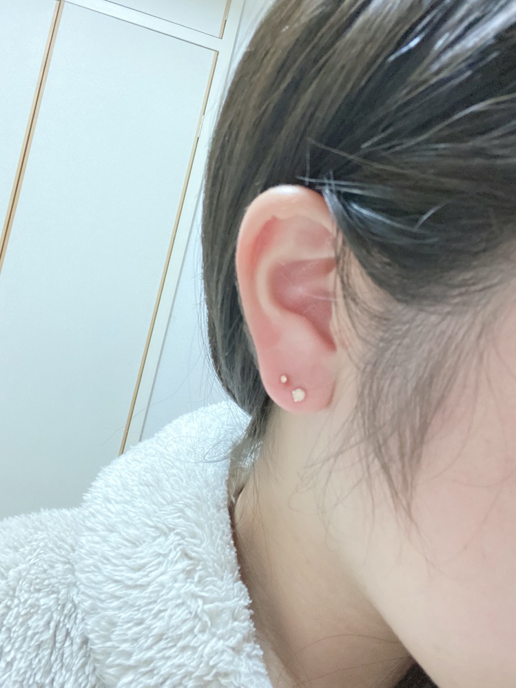 2つ目のピアスを開けたのですが近すぎますかね…位置変ですか…？金色の 2個目
