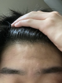 このデコの狭さはセンター分け似合わないですかね ワンオクのtakaさ Yahoo Beauty