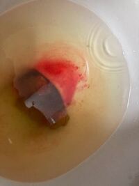 閲覧要注意です ずっと便秘でひさしぶりに便が出たら一緒に大 Yahoo 知恵袋