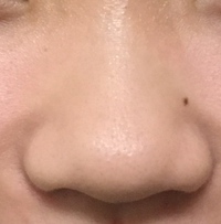 女子中学3年生です 鼻について質問です汚いですが写真を貼ります Yahoo 知恵袋