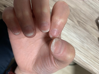 ハンドケアのパラフィンパックについて質問です サロンで導入してらっし Yahoo 知恵袋