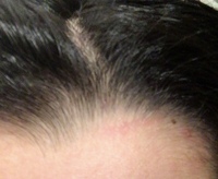 お父さんに髪を引っ張られて痕ができました これは虐待に入りますか Yahoo 知恵袋