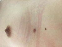 物心ついたころから右側の胸の下に乳首のようなものがあります 色や触った感 Yahoo 知恵袋