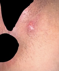 お見苦しい写真失礼します 先日も同じ内容で質問させていただいた Yahoo 知恵袋