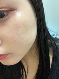 ファンデーションを塗って 時間が経った肌を近くで見るとひび割れた Yahoo 知恵袋