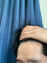 若ハゲですか 笑 学生なんですけど大丈夫ですかね Yahoo 知恵袋
