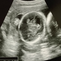 現在妊娠21週目の妊婦です 今のところ特に胎児の異常を告げられてい Yahoo 知恵袋