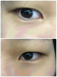 この目は瞼伸びてますか あと二重のくせ着くと思いますか 左はつ Yahoo 知恵袋