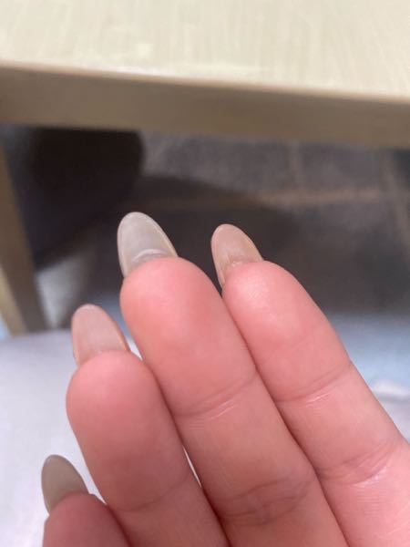 ネイルケア 解決済みの質問 Yahoo 知恵袋