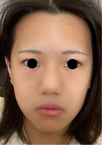 整形をしたいと思っています 私の顔で直したら良いところを教えて Yahoo 知恵袋