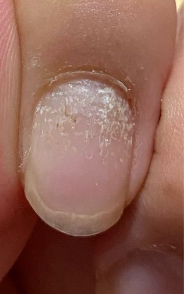 ネイルケア すべての質問 Yahoo 知恵袋