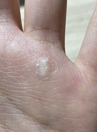 皮膚について詳しい方教えてくださいm M こちらマメ Yahoo 知恵袋