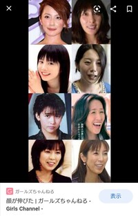 代中後半以降 特に中顔面 及び顔の下半分が伸びて面長になる Yahoo 知恵袋