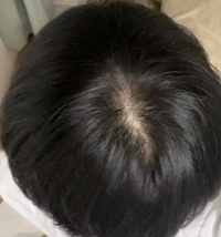 つむじが画像のように後ろかつ真ん中ではない所にあるので左右で Yahoo 知恵袋