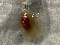 ここのところずっと息苦しくて痰も絡み辛かったなですが 血痰が出 Yahoo 知恵袋