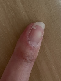 昨日いつの間にか写真のように爪が割れてしまっていて今日気づいた Yahoo 知恵袋
