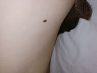 少し恥ずかしい話なのですが 脇腹のほくろが大きくなってきてるような Yahoo 知恵袋
