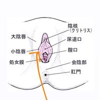 昨日お股が痒くて擦ってかきむしっていたら この画像でいう小陰唇 Yahoo 知恵袋