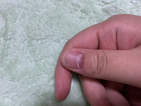 爪がほんの少し剥がれ ました 右手親指の爪が 爪先4 5ミ Yahoo 知恵袋