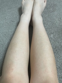 足の毛穴が汚くて悩んでいます 処理したあと保湿などはしっかりし Yahoo 知恵袋