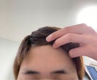 眉毛は一生生えてこないものですか 中学の頃から剃って抜いてを繰 Yahoo 知恵袋