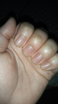 飲食店のバイト この爪の長さは大丈夫 もともと深爪歴が長く ピンクの部分 Yahoo 知恵袋