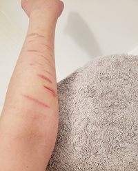 彼女の腕がこんな感じだとどう思いますか 薄着の季節になってきて Yahoo 知恵袋