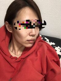 頬コケを治すというか顔がふっくらする方法ってありませんか 痩せやすい体質で Yahoo 知恵袋