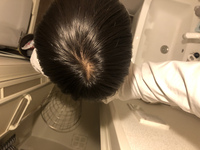 オレンジ色の光の下で撮った写真です 直毛軟毛なので頭頂部あたりが薄く見えるのはしょうがないんですが朝寝癖直しでドライヤーしただけで20本 前後抜けました笑枕にはない時が多いです この際高2でスキンヘッドデビューしたほうがいいですよね？笑