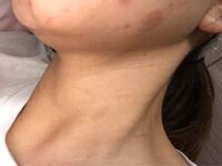 最近首やこめ髪 手首や手がかゆくこの様に荒れています 花 Yahoo 知恵袋