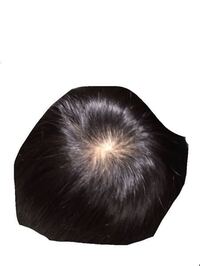 これって禿げてますよね 中学生です薄毛を治すためにはどんな病院に行 Yahoo 知恵袋