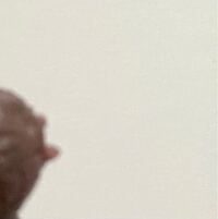 妊娠９ヶ月目なのですが 乳頭にできたこれ 授乳が終われば治るのでしょうか Yahoo 知恵袋