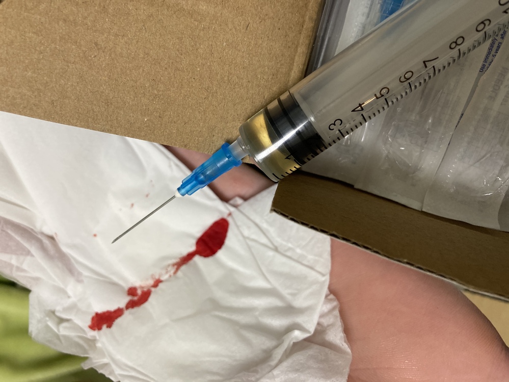 アナボリックステロイド注射剤についてです 注射後出血する時があ Yahoo 知恵袋