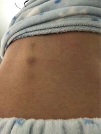 1年ほど前から背骨に沿って背中がざらざらしているなと思い 今日初めて自分 Yahoo 知恵袋