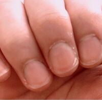 二枚爪になっています 水仕事をしているので頻繁には塗れてい Yahoo 知恵袋