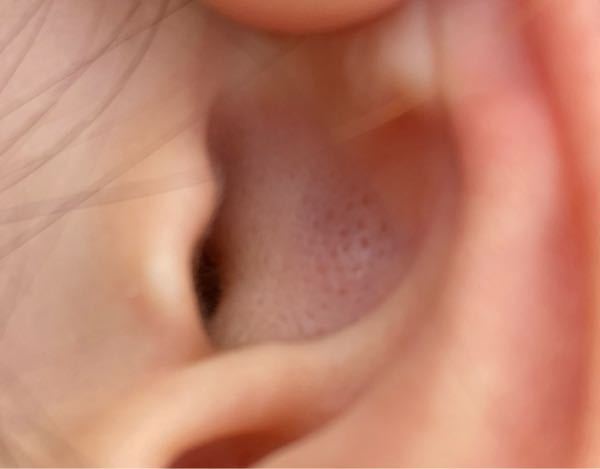 耳の病気 投票受付中の質問 Yahoo 知恵袋