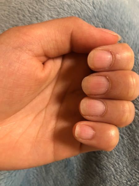 ネイル落とした後すぐに撮った写真なので爪が白くなっています Yahoo 知恵袋