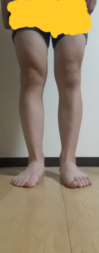 高校生男子です 足を細くしたいです この足を見てどんな事をしたら細くなる Yahoo 知恵袋