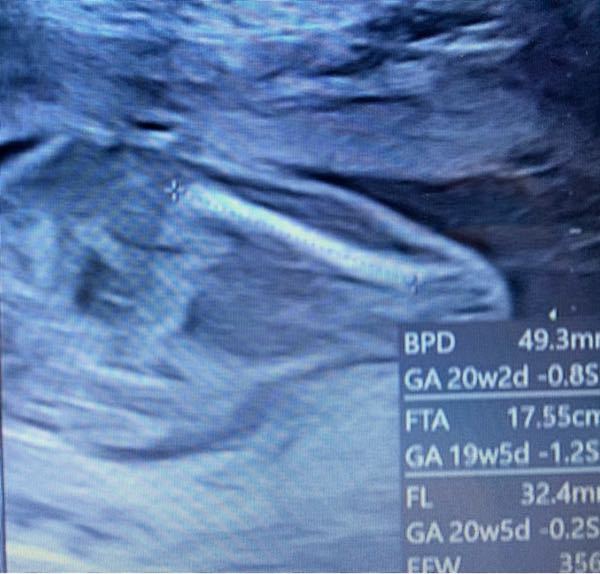 妊婦6ヶ月目の妊婦です 性別どちらだと思いますか つい Yahoo 知恵袋