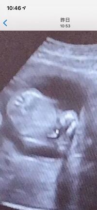 妊娠15週目に入り検診で男の子かなぁと突起物らしいものが見えた Yahoo 知恵袋